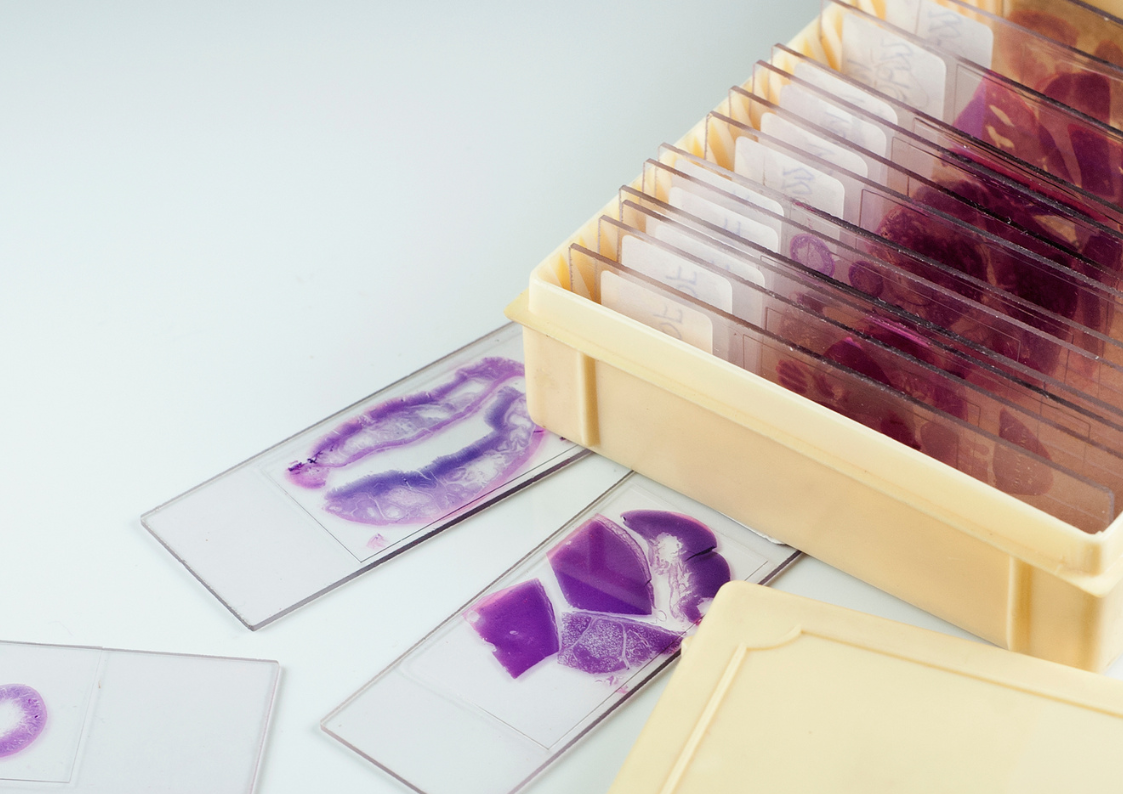 Второе мнение в гистологии