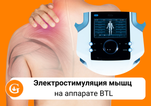 электростимуляция