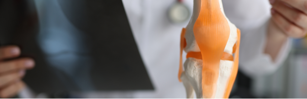 рентген-коленного-сустава