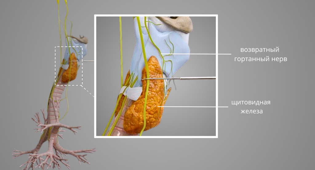 интраоперационный-нейромониторинг