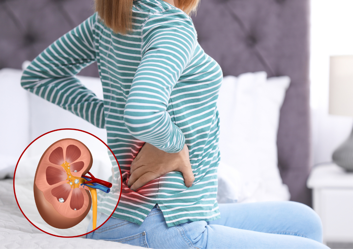 лечение-рака-почек